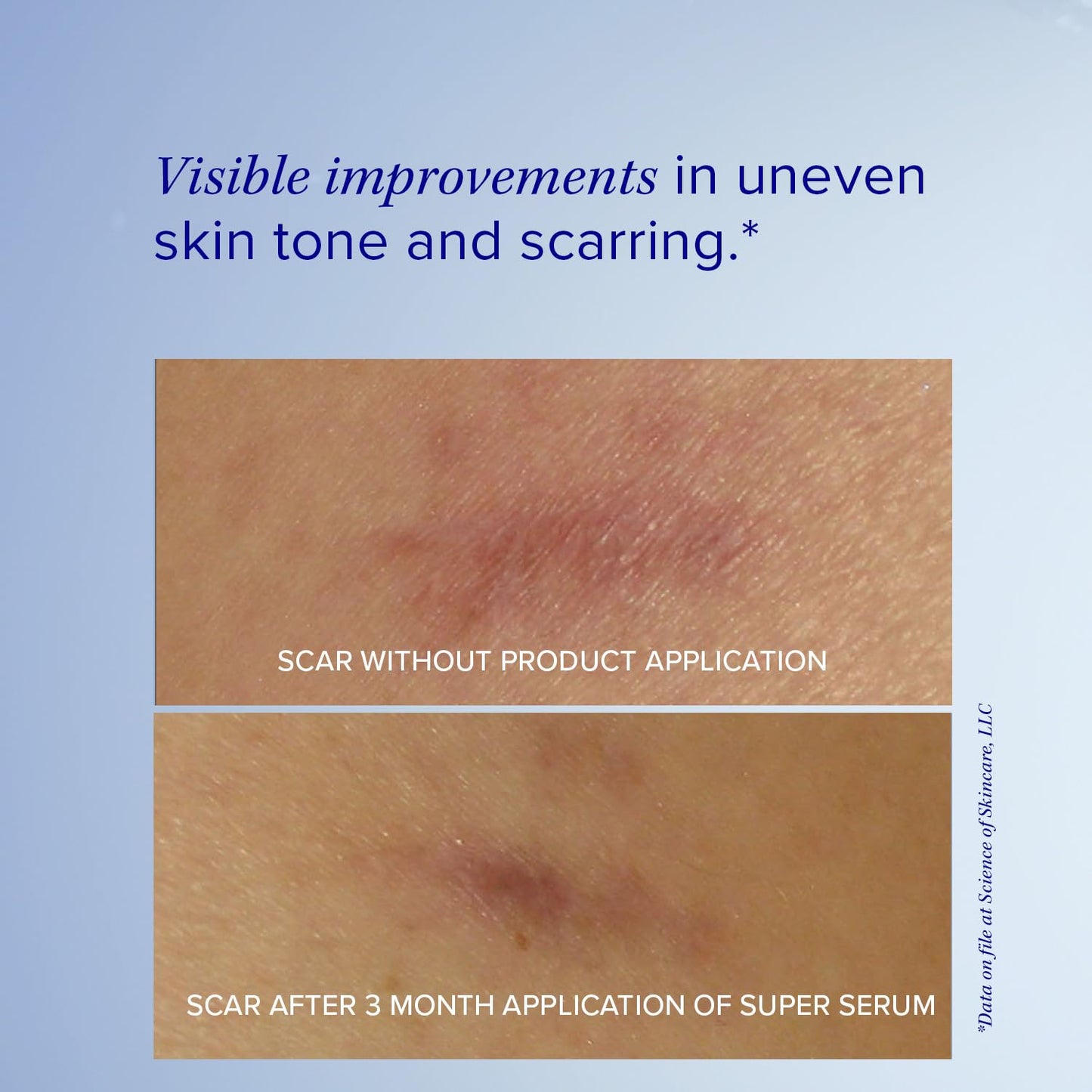 Anti-Aging Vitamin C Face Serum